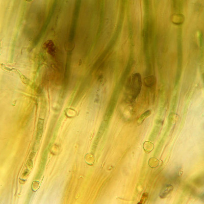 Trichomes - Bases - Magnified