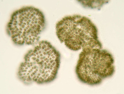 Colonies - Surface Focus - Magnified