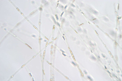 Magnified Distal Ends of Trichomes