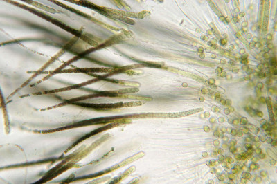 Colony-Squashed-Trichomes - Bases - Microscope Low Magnification