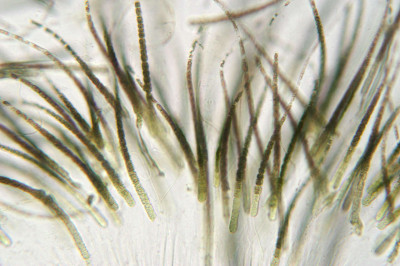 Colony-Squashed - Trichomes - Bases - Microscope low magnification