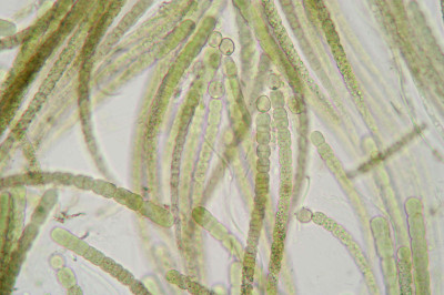 Magnified Trichomes with Heterocysts