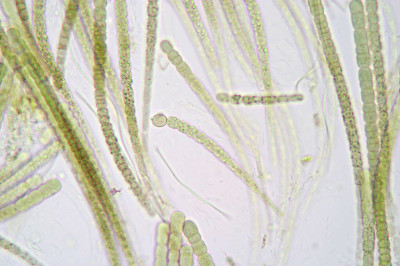 Trichomes - Magnified