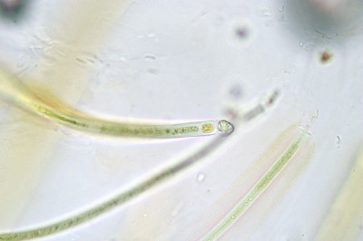 Magnified Trichome with Well-Developed Hairs