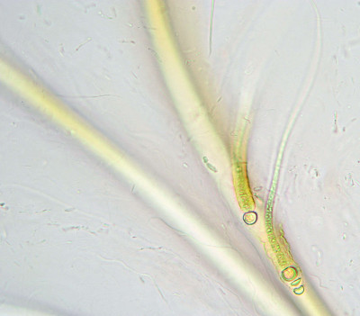 Magnified Trichomes