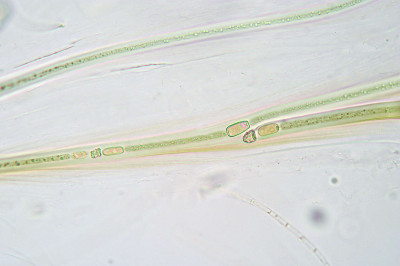 Trichomes - Magnified