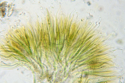 Trichomes: Observations Under Low Magnification