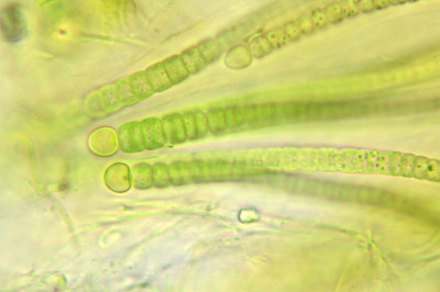 Trichome Bases with Heterocysts - Highly Magnified