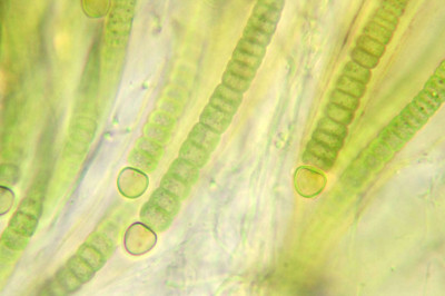 Trichome Bases with Heterocysts - Highly Magnified