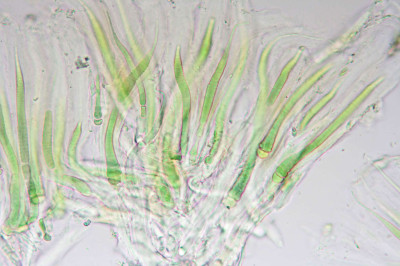 Magnified Trichomes