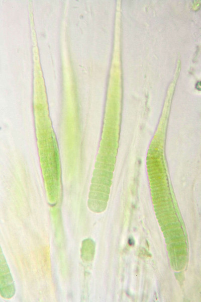 Trichomes - Highly Magnified