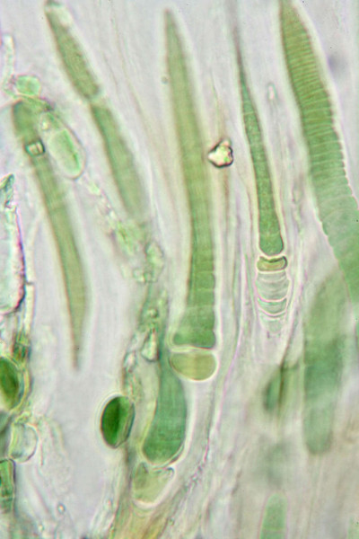 Trichomes - highly magnified