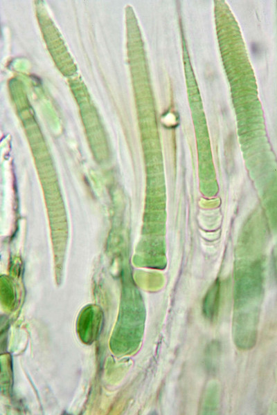 Trichomes - Highly Magnified