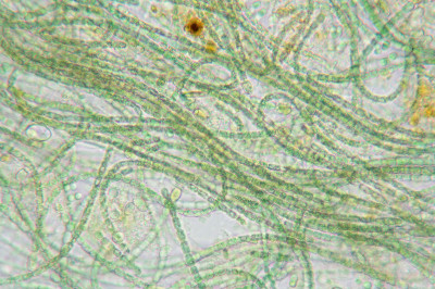 Magnified Filaments with Heterocysts