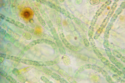 Highly Magnified Filaments with Heterocysts