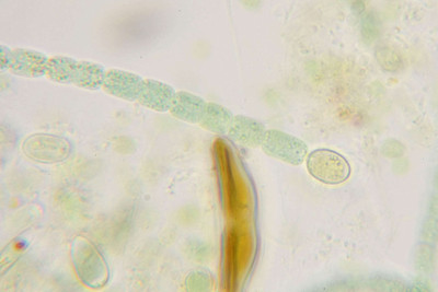 Filament - with Heterocyst - Highly Magnified