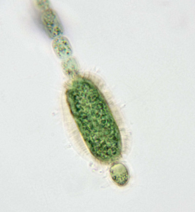 Filament with Akinete and Heterocyst - Highly Magnified