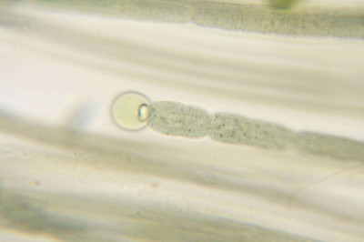 Lower Surface of Frogbit Leaf in an Artificial Pond