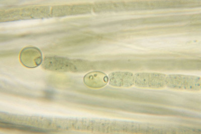 Trichome Bases with Heterocysts - Highly Magnified