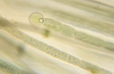 Trichome Base with Heterocyst - Highly Magnified