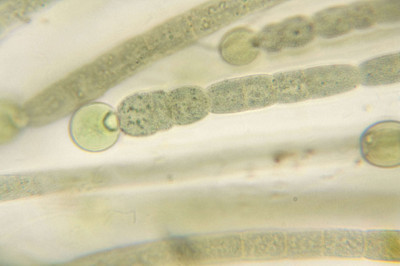 Trichome Base with Heterocyst - Highly Magnified