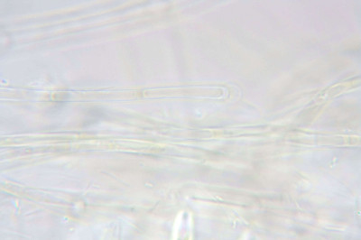 Highly Magnified Trichome Tails