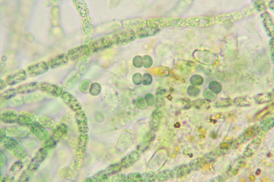 Cell Pairs - Highly Magnified