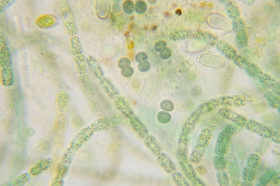 Cell Pairs - Highly Magnified