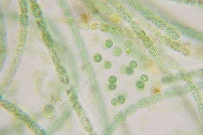 Cell Pairs - Highly Magnified