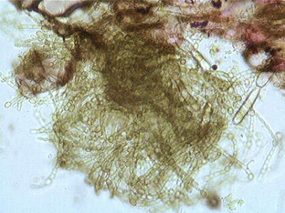 Trichome mass extracted from Azolla leaf