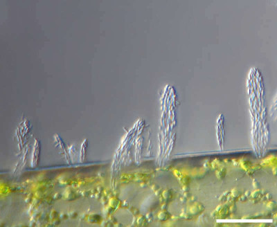 <em>Zoogloea ramigera</em>