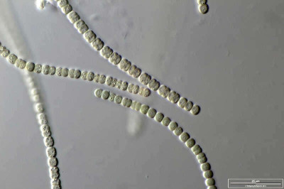 Microscopic View of Nostoc commune from Kiel Garden