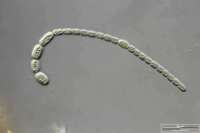 Anabaena Specimen from Wetland Near Pillersee, Tyrol