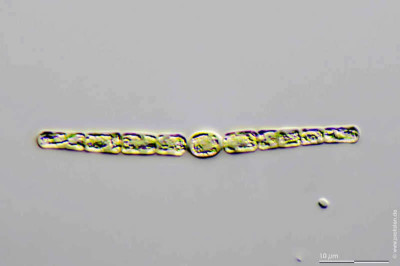 Microscopic Analysis of Anabaena from Tyrol Wetland