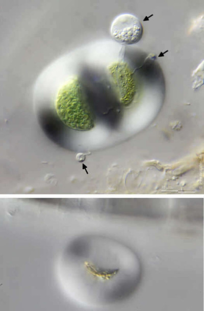 Chroococcus turgidus with chytrid parasite