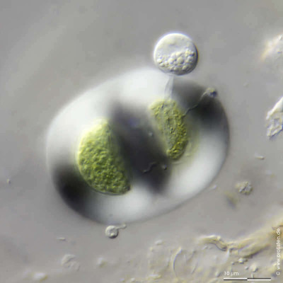 Chroococcus turgidus with chytrid parasite