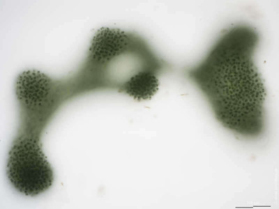 Microcystis aeruginosa