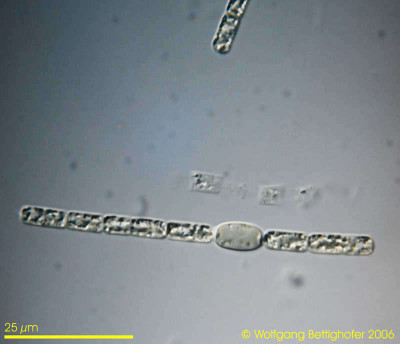 Aphanizomenon Specimen from Kiel's Rain Storage Reservoir