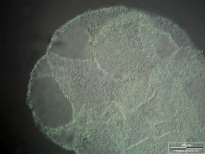 Pelodictyon Luteolum in Wetlands