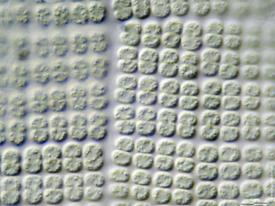 Merismopedia elegans Scale Bar Indicates 5 µm