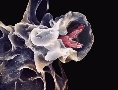 Macrophage Interaction with Tuberculosis Bacteria