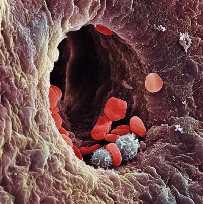 Capillary Dynamics with Red and White Blood Cells