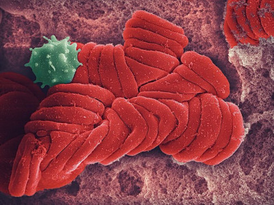 Red Blood Cells Trapped in Fibrin Mesh