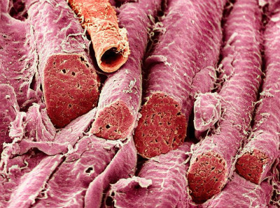 Muscle Fibers and Blood Vessel