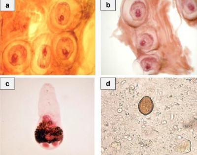Different stages of Heterophyes heterophyes Parasite