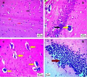 Brain Sections of Mice of Infected with Toxoplasmosis: Marwa Omar