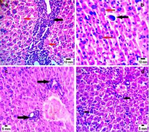 Liver Sections of Mice Infected with Toxoplasomsis: Marwa Omar