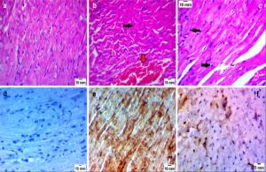 Cardiac Sections of Mice Infected with Toxoplasmosis: Marwa Omar