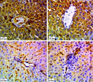 Nitric Oxide Expression in the Liver Sections of Toxplasmosis
