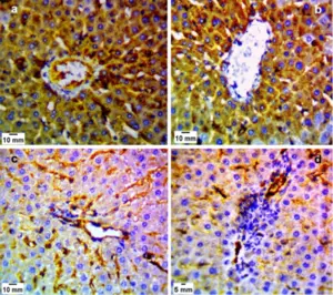 Nitric Oxide Expression in the Liver Sections of Toxplasmosis
